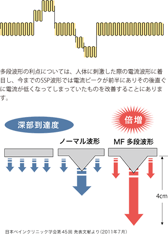 SSPに「MF 多段波形（PAT.第5031861）」新規追加搭載