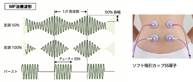 MF治療モードイメージ画像