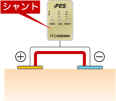 シャント