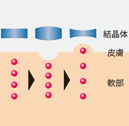 1秒間に数百万回のミクロマッサージ効果