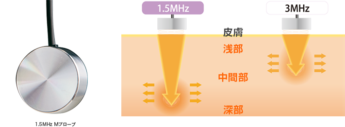 軟部組織の治療に適した低出力超音波