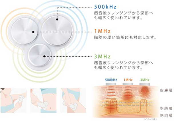 serapm_01_detail[1]